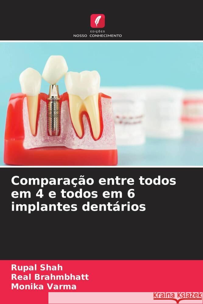 Compara??o entre todos em 4 e todos em 6 implantes dent?rios Rupal Shah Real Brahmbhatt Monika Varma 9786203553024