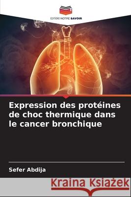 Expression des protéines de choc thermique dans le cancer bronchique Abdija, Sefer 9786203573121 Editions Notre Savoir