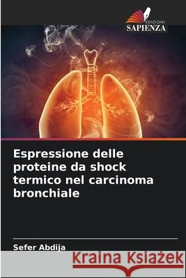 Espressione delle proteine da shock termico nel carcinoma bronchiale Abdija, Sefer 9786203573190 Edizioni Sapienza