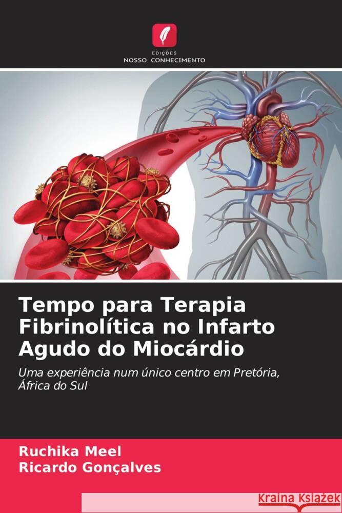 Tempo para Terapia Fibrinolítica no Infarto Agudo do Miocárdio Meel, Ruchika, Gonçalves, Ricardo 9786203579673