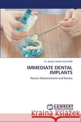 Immediate Dental Implants Swathi Vardhan Kasi Kasi 9786203581836 LAP Lambert Academic Publishing