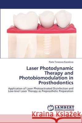 Laser Photodynamic Therapy and Photobiomodulation in Prosthodontics Rada Torezova Kazakova 9786203582291
