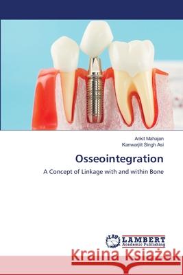 Osseointegration Ankit Mahajan Kanwarjiit Sing 9786203583250