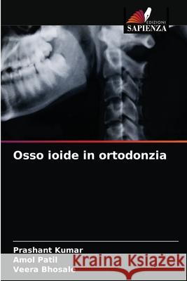 Osso ioide in ortodonzia Prashant Kumar, Amol Patil, Veera Bhosale 9786203596847