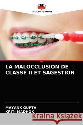 La Malocclusion de Classe II Et Sagestion Mayank Gupta Kriti Madhok 9786203598414 Editions Notre Savoir