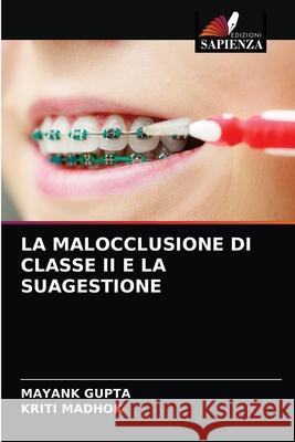 La Malocclusione Di Classe II E La Suagestione Mayank Gupta Kriti Madhok 9786203598421