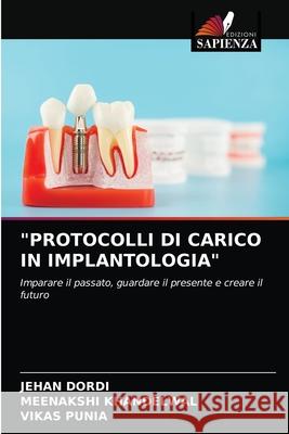 Protocolli Di Carico in Implantologia Jehan Dordi Meenakshi Khandelwal Vikas Punia 9786203604146 Edizioni Sapienza