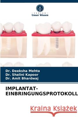 Implantat-Einbringungsprotokoll Dr Deeksha Mehta, Dr Shalini Kapoor, Dr Amit Bhardwaj 9786203607420