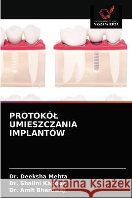 Protokól Umieszczania Implantów Dr Deeksha Mehta, Dr Shalini Kapoor, Dr Amit Bhardwaj 9786203607475