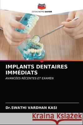 Implants Dentaires Immédiats Kasi, Dr Swathi Vardhan 9786203608304