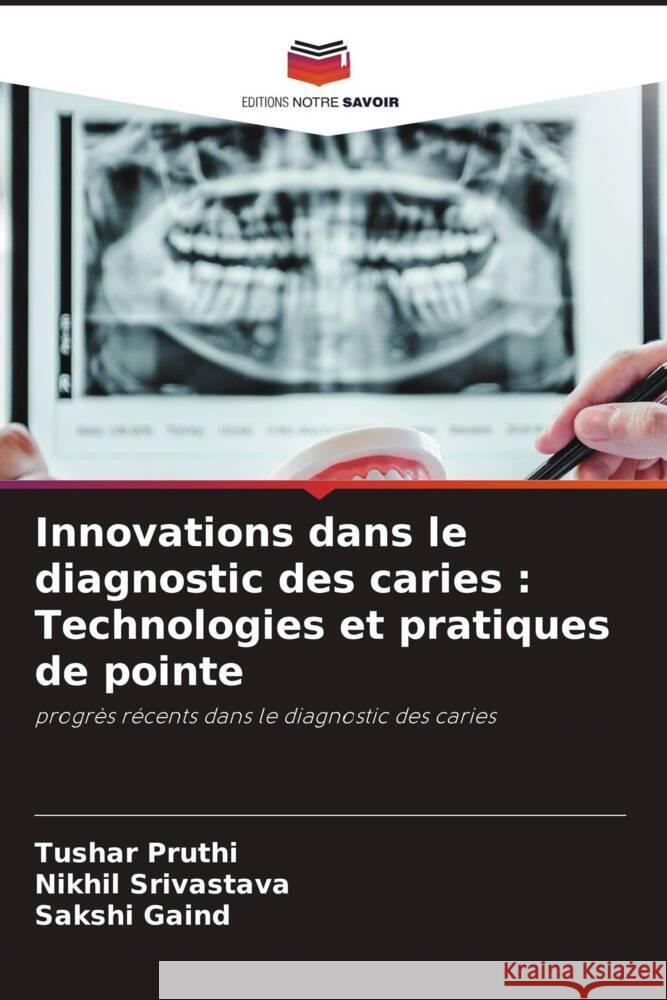 Innovations dans le diagnostic des caries : Technologies et pratiques de pointe Pruthi, Tushar, Srivastava, Nikhil, Gaind, Sakshi 9786203614145