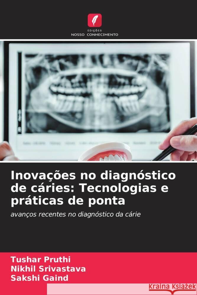 Inovações no diagnóstico de cáries: Tecnologias e práticas de ponta Pruthi, Tushar, Srivastava, Nikhil, Gaind, Sakshi 9786203614169