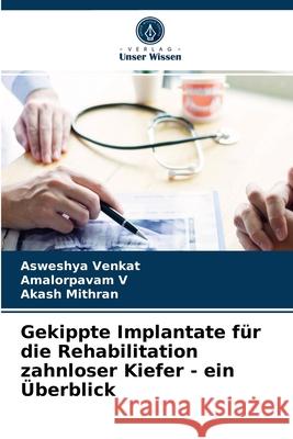 Gekippte Implantate für die Rehabilitation zahnloser Kiefer - ein Überblick Asweshya Venkat, Amalorpavam V, Akash Mithran 9786203617047 Verlag Unser Wissen