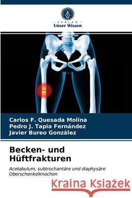 Becken- und Hüftfrakturen Carlos F Quesada Molina, Pedro J Tapia Fernández, Javier Bureo González 9786203641059 Verlag Unser Wissen