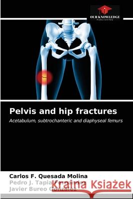Pelvis and hip fractures Carlos F Quesada Molina, Pedro J Tapia Fernández, Javier Bureo González 9786203641066 Our Knowledge Publishing