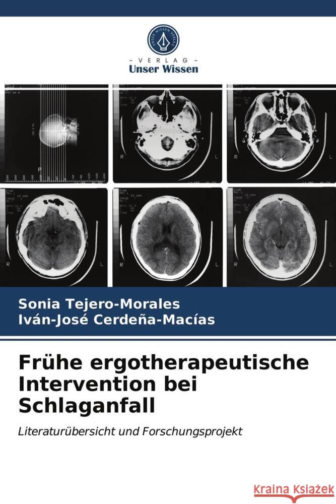 Frühe ergotherapeutische Intervention bei Schlaganfall Tejero-Morales, Sonia, Cerdeña-Macías, Iván-José 9786203648263