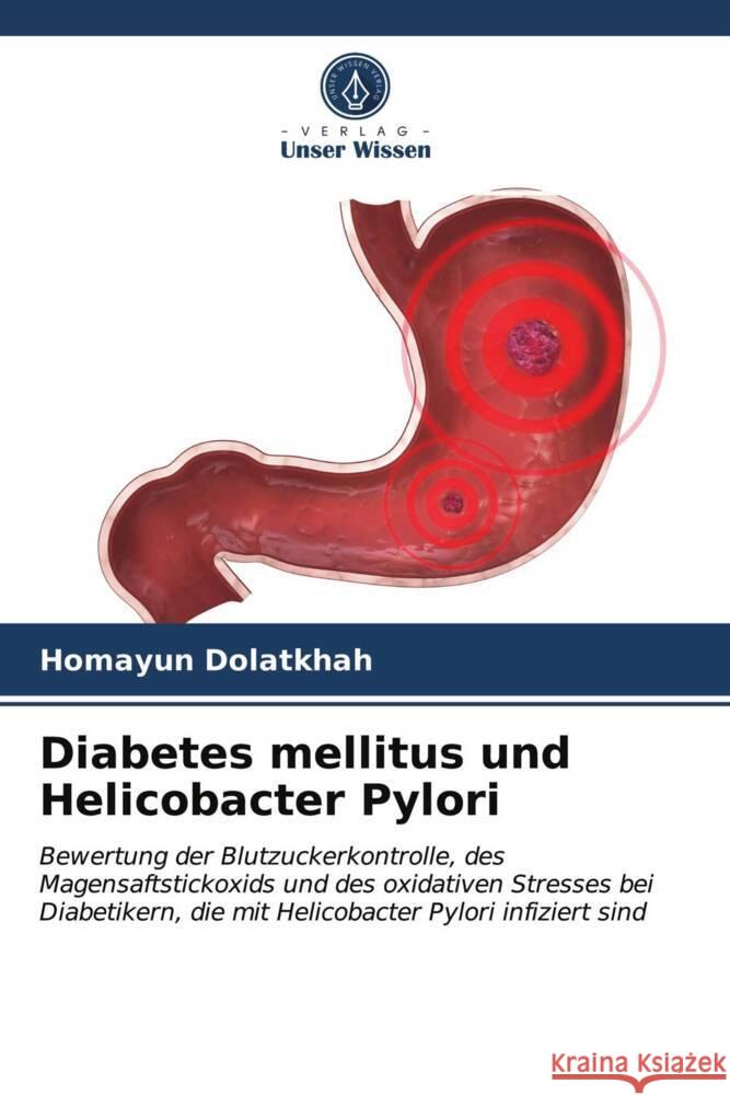 Diabetes mellitus und Helicobacter Pylori Dolatkhah, Homayun 9786203665383 Verlag Unser Wissen