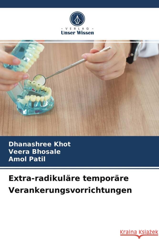 Extra-radikuläre temporäre Verankerungsvorrichtungen Khot, Dhanashree, Bhosale, Veera, Patil, Amol 9786203671025 Verlag Unser Wissen