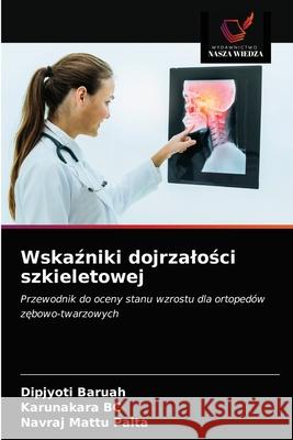 Wskaźniki dojrzalości szkieletowej Baruah, Dipjyoti 9786203677546 Wydawnictwo Nasza Wiedza