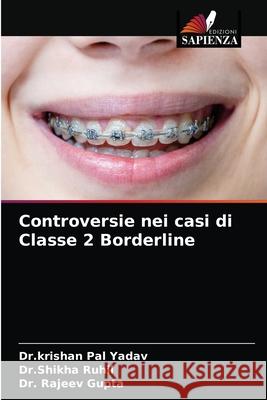 Controversie nei casi di Classe 2 Borderline Dr Krishan Pal Yadav Dr Shikha Ruhil Rajeev Gupta 9786203679298 Edizioni Sapienza