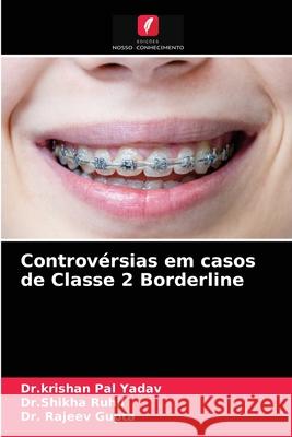 Controvérsias em casos de Classe 2 Borderline Yadav, Dr Krishan Pal 9786203679328 Edicoes Nosso Conhecimento