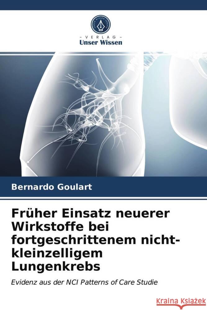 Früher Einsatz neuerer Wirkstoffe bei fortgeschrittenem nicht-kleinzelligem Lungenkrebs Goulart, Bernardo 9786203693843