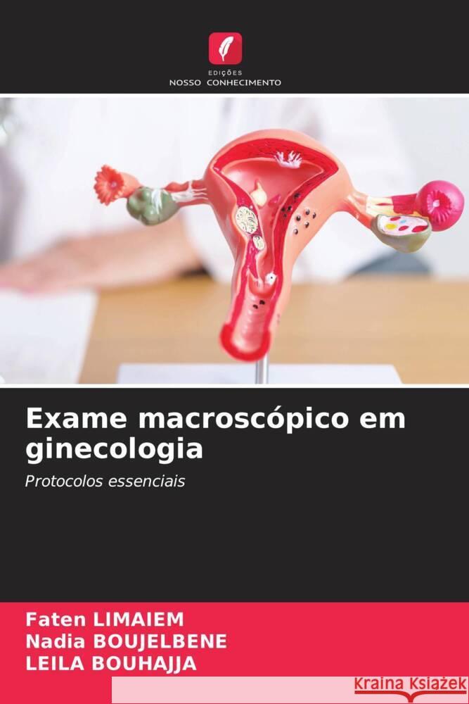Exame macroscópico em ginecologia Limaiem, Faten, BOUJELBENE, Nadia, BOUHAJJA, Leila 9786203694932