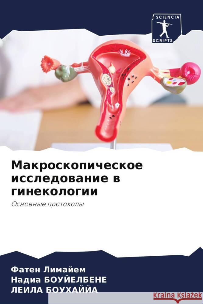 Makroskopicheskoe issledowanie w ginekologii Limajem, Faten, BOUJELBENE, Nadia, BOUHAJJA, Leila 9786203694949