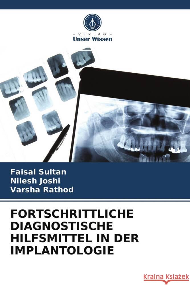 FORTSCHRITTLICHE DIAGNOSTISCHE HILFSMITTEL IN DER IMPLANTOLOGIE Sultan, Faisal, Joshi, Nilesh, Rathod, Varsha 9786203699296