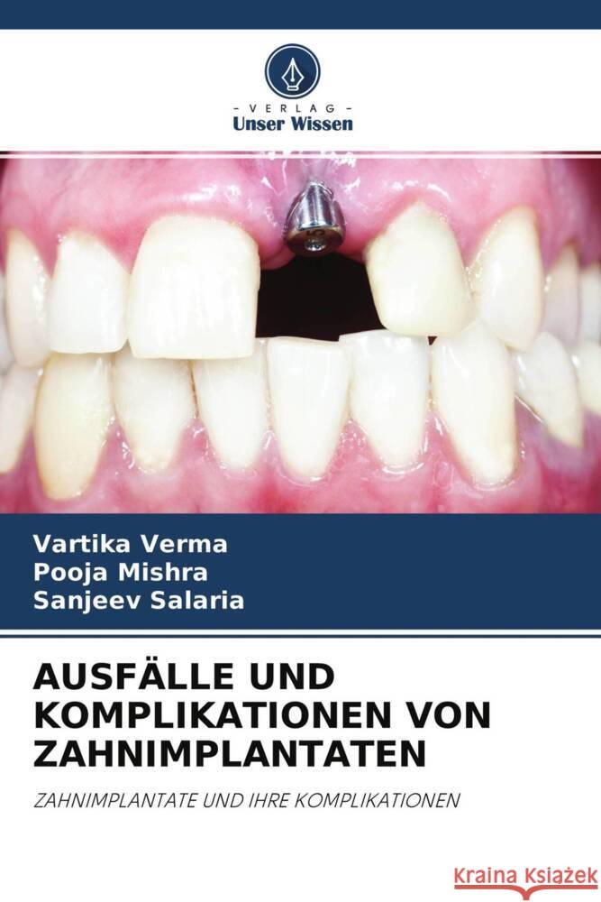 AUSFÄLLE UND KOMPLIKATIONEN VON ZAHNIMPLANTATEN Verma, Vartika, Mishra, Pooja, Salaria, Sanjeev 9786203732283