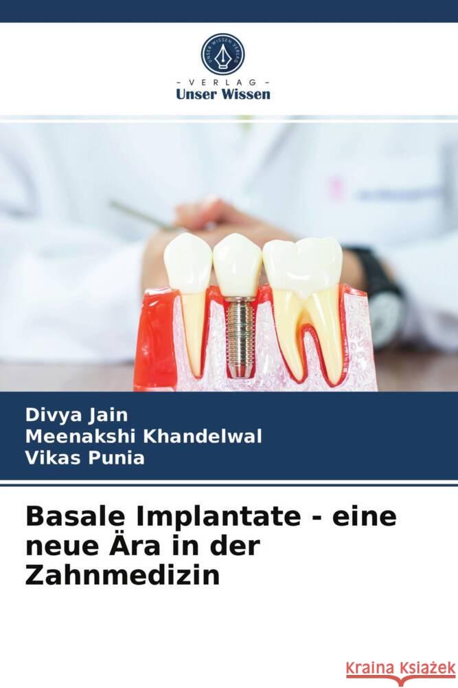 Basale Implantate - eine neue Ära in der Zahnmedizin Jain, Divya, Khandelwal, Meenakshi, Punia, Vikas 9786203741940