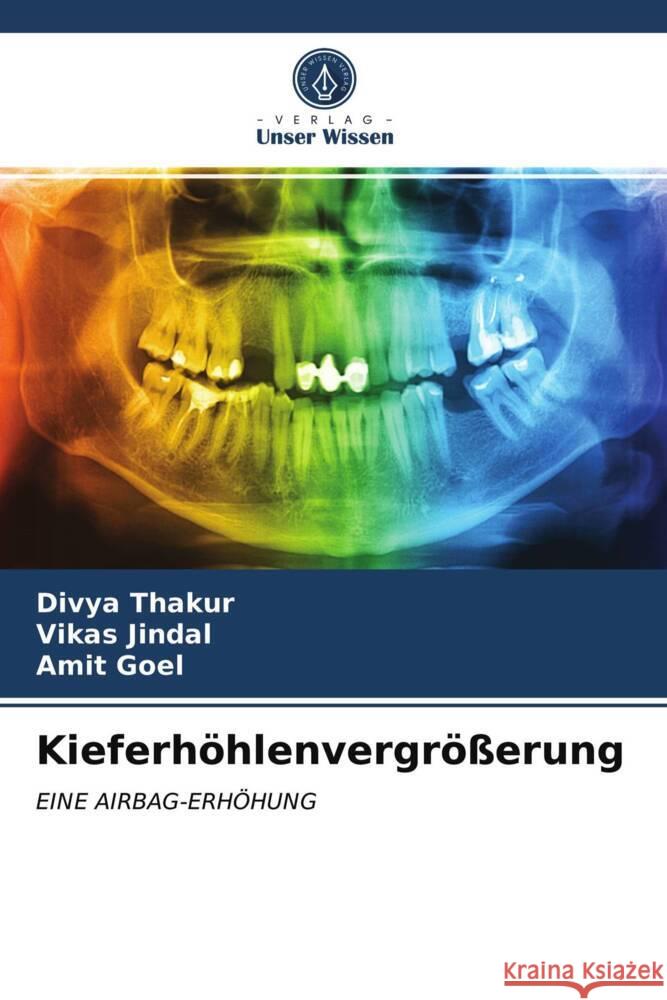 Kieferhöhlenvergrößerung Thakur, Divya, Jindal, Vikas, Goel, Amit 9786203744064 Verlag Unser Wissen