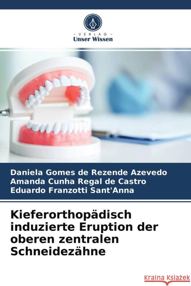 Kieferorthopädisch induzierte Eruption der oberen zentralen Schneidezähne de Rezende Azevedo, Daniela Gomes, Regal de Castro, Amanda Cunha, Sant'Anna, Eduardo Franzotti 9786203746167