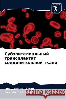 Субэпителиальный транс&# Ранджk 9786203756098 Sciencia Scripts