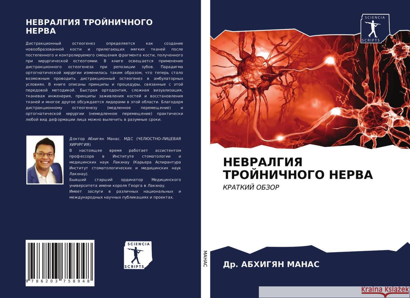 NEVRALGIYa TROJNIChNOGO NERVA MANAS, Dr. ABHIGYAN 9786203758948
