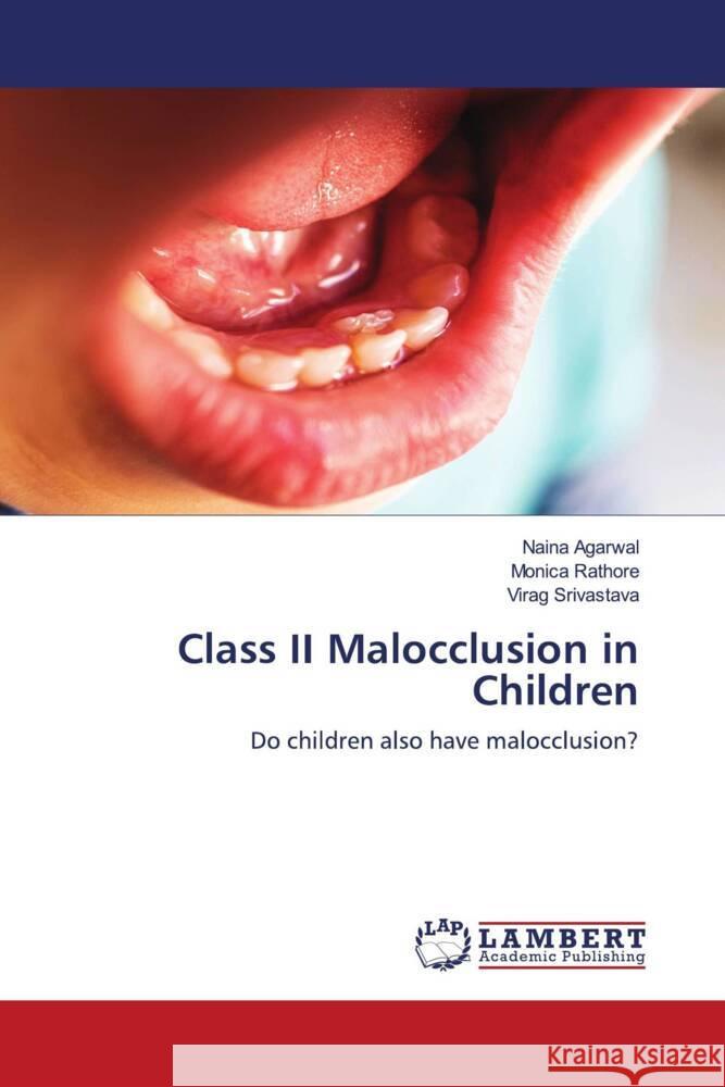 Class II Malocclusion in Children Agarwal, Naina, Rathore, Monica, Srivastava, Virag 9786203839869