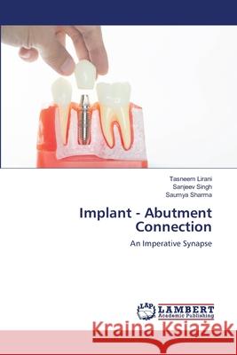 Implant - Abutment Connection Tasneem Lirani Sanjeev Singh Saumya Sharma 9786203841022 LAP Lambert Academic Publishing