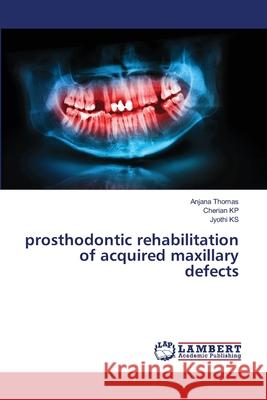 prosthodontic rehabilitation of acquired maxillary defects Anjana Thomas Cherian Kp Jyothi Ks 9786203847079