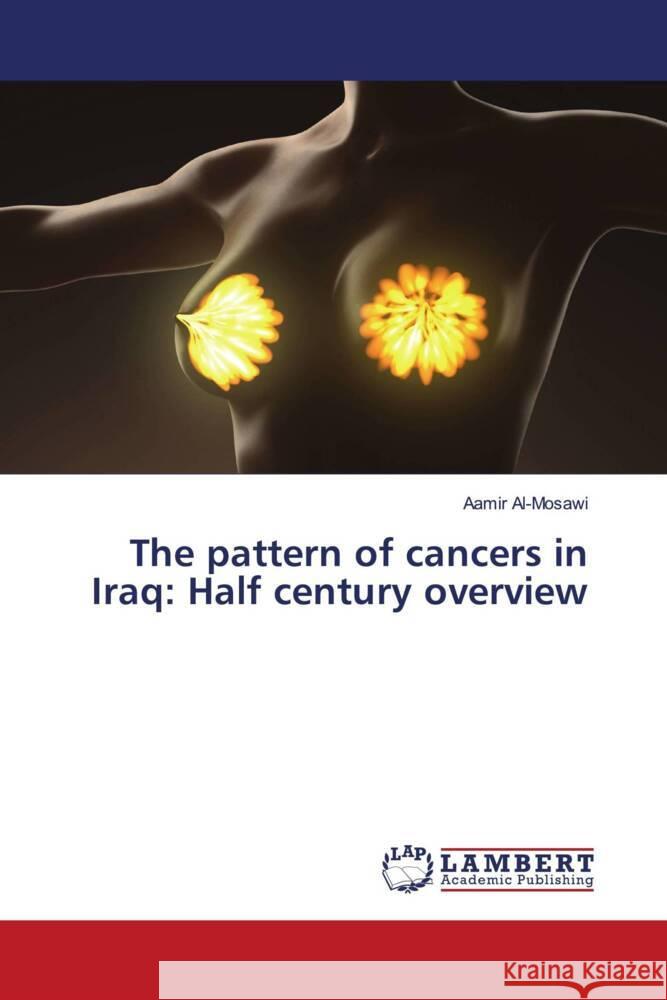 The pattern of cancers in Iraq: Half century overview Al'-Mosawi, Aamir 9786203847468 LAP Lambert Academic Publishing