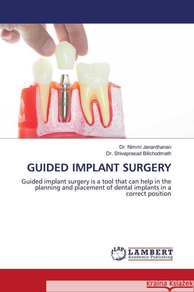 GUIDED IMPLANT SURGERY Janardhanan, Dr. Nimmi, Bilichodmath, Dr. Shivaprasad 9786203853735