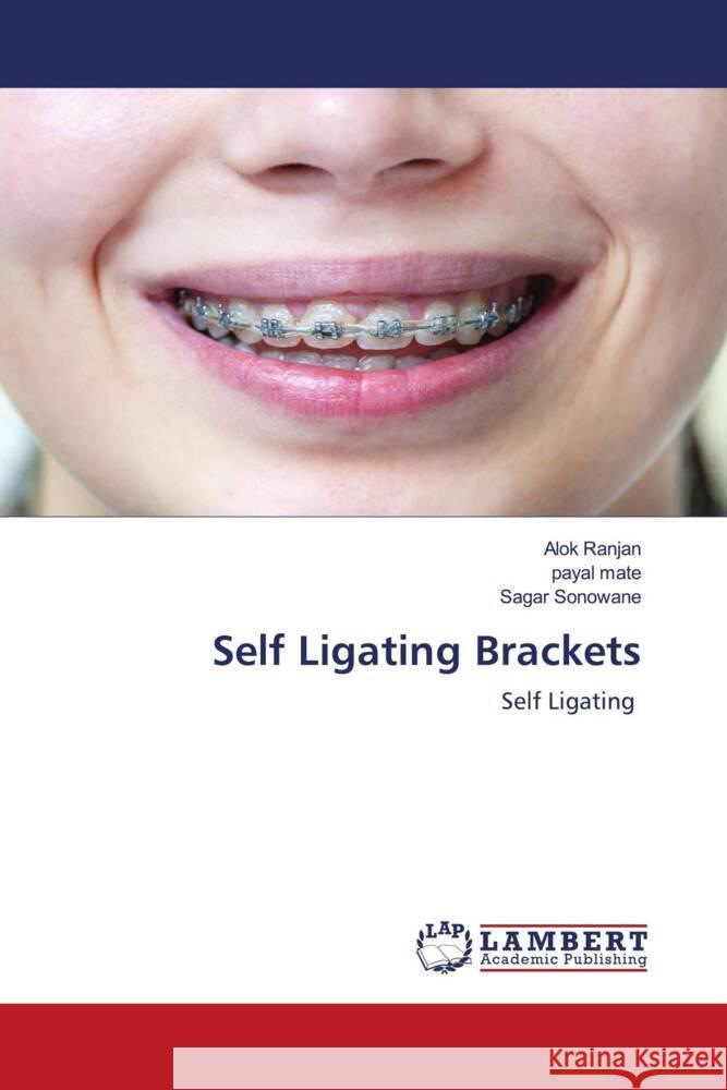 Self Ligating Brackets Ranjan, Alok, mate, payal, Sonowane, Sagar 9786203854084 LAP Lambert Academic Publishing