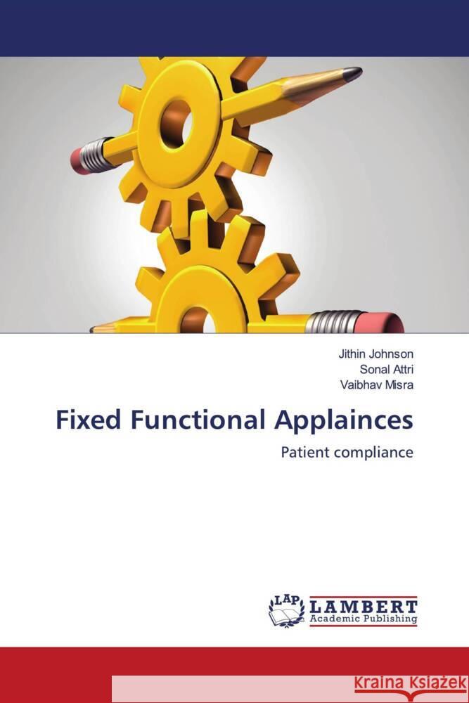 Fixed Functional Applainces Johnson, Jithin, Attri, Sonal, Misra, Vaibhav 9786203854091