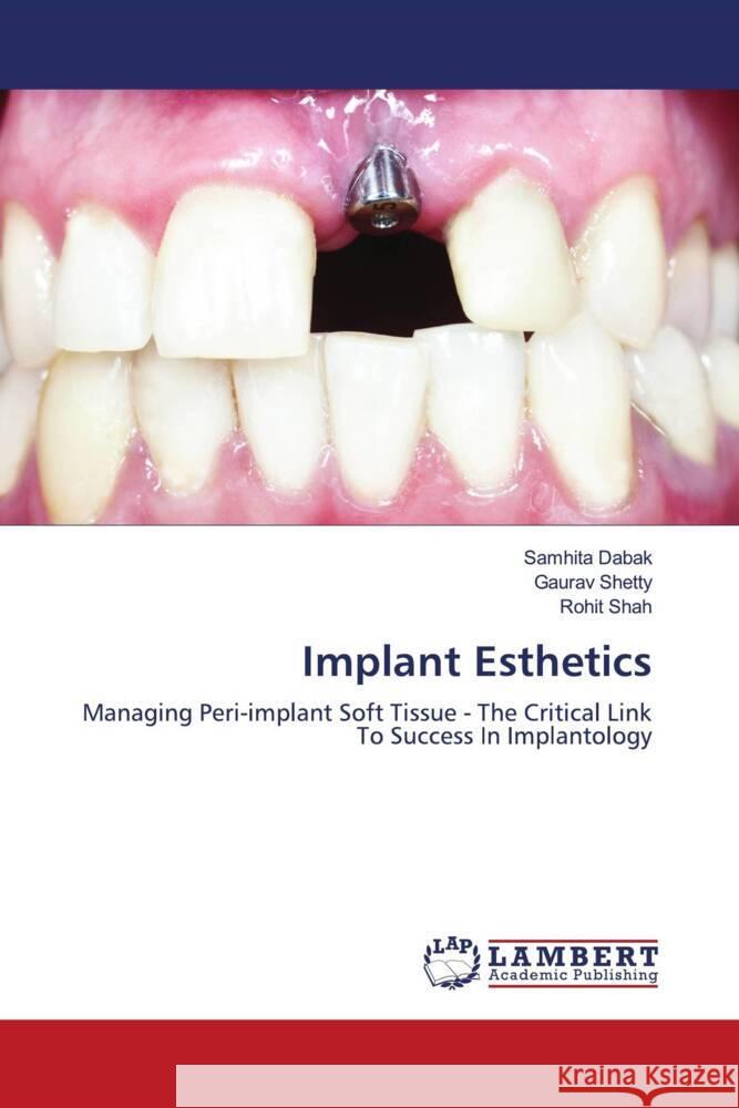 Implant Esthetics Dabak, Samhita, Shetty, Gaurav, Shah, Rohit 9786203854299