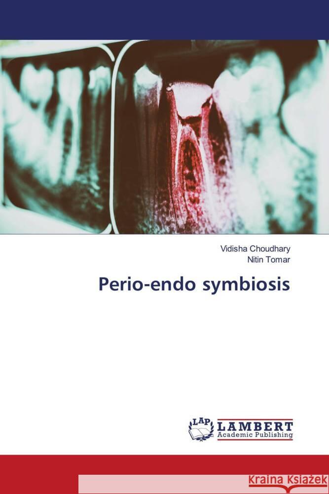 Perio-endo symbiosis Choudhary, Vidisha, Tomar, Nitin 9786203855746 LAP Lambert Academic Publishing