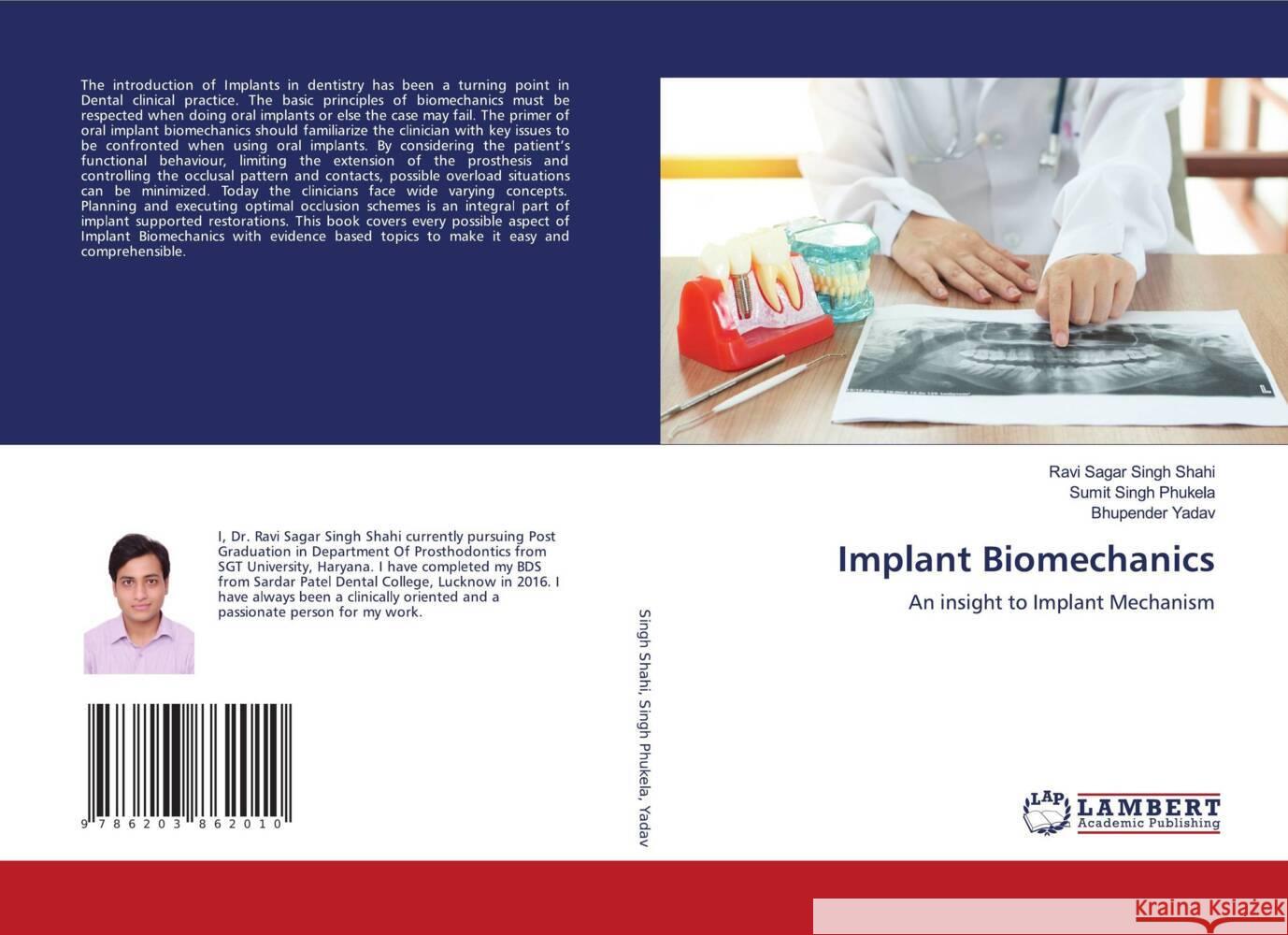 Implant Biomechanics Singh Shahi, Ravi Sagar, Singh Phukela, Sumit, Yadav, Bhupender 9786203862010