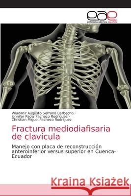 Fractura mediodiafisaria de clavícula Serrano Barbecho, Wladimir Augusto 9786203873276