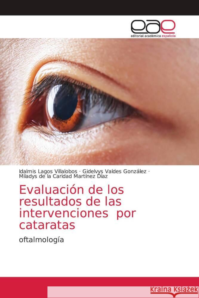 Evaluación de los resultados de las intervenciones por cataratas Lagos Villalobos, Idalmis, Valdes González, Gidelvys, Martínez Díaz, Miladys de la Caridad 9786203874099