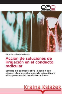 Acción de soluciones de irrigación en el conducto radicular Salas López, María Mercedes 9786203874884