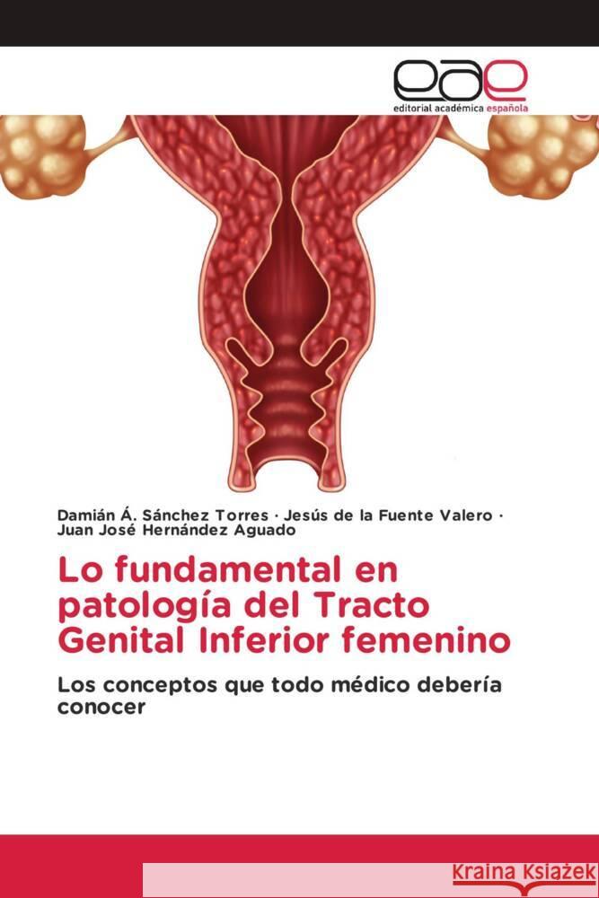 Lo fundamental en patología del Tracto Genital Inferior femenino Sánchez Torres, Damián Á., de la Fuente Valero, Jesús, Hernández Aguado, Juan José 9786203880878