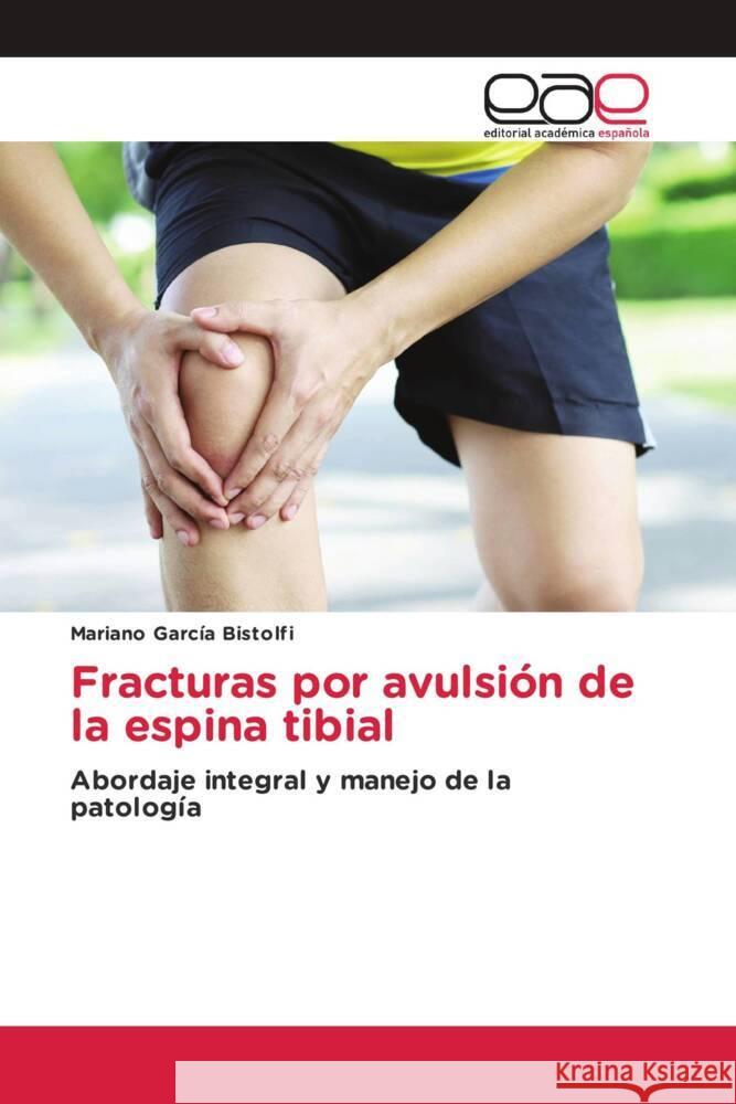 Fracturas por avulsión de la espina tibial García Bistolfi, Mariano 9786203885842 Editorial Académica Española